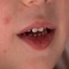 img1